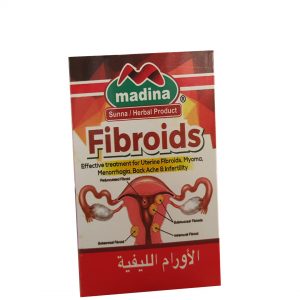 Fibroids uvimbe mioma